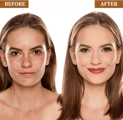 ✨The Magic Color-Changing Stick: Flawless Coverage Meets 24H Hydration