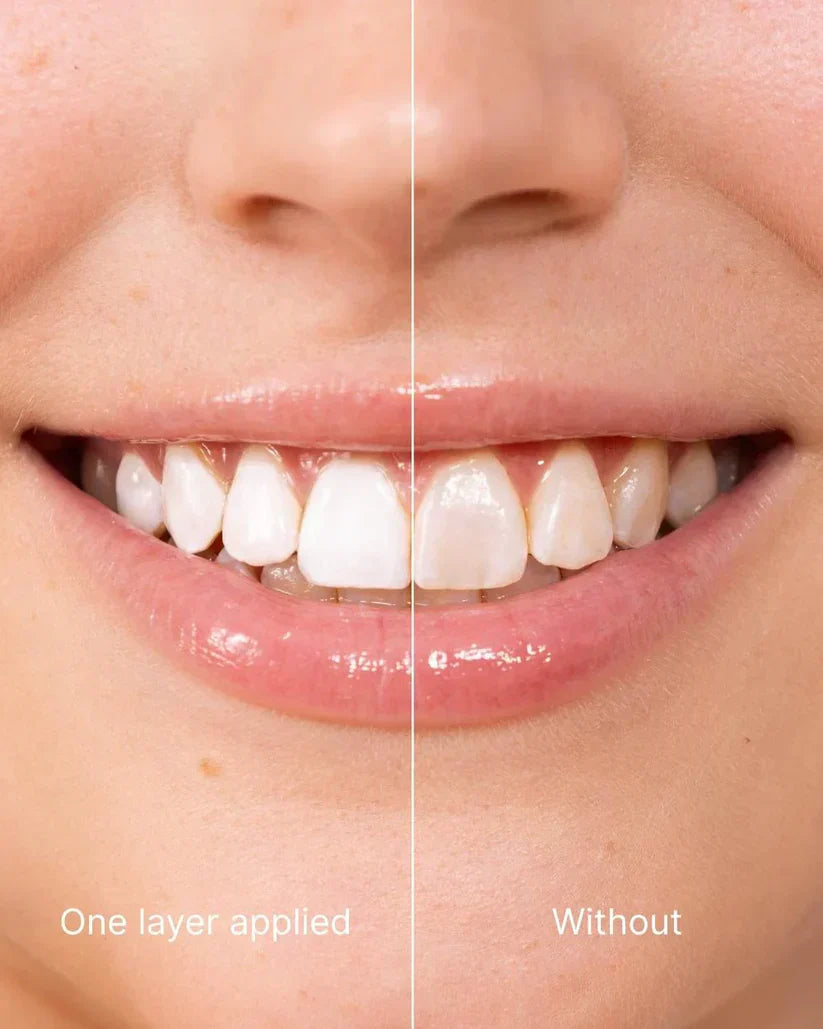 LEVYNODE™ Tooth Polish