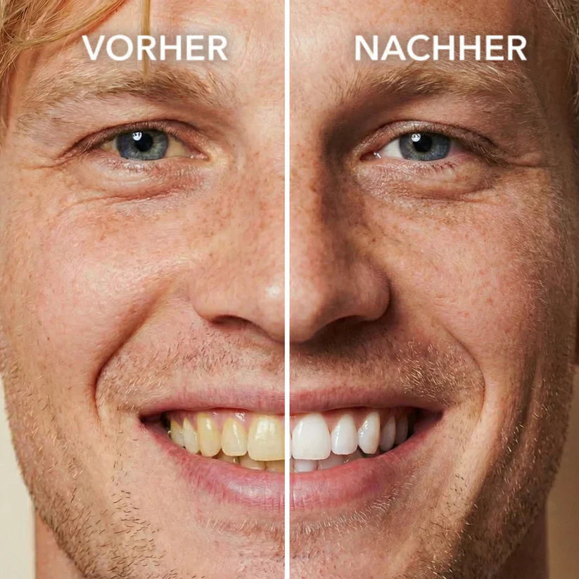 LEVYNODE™ Tooth Polish