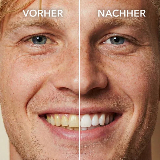 LEVYNODE™ Tooth Polish